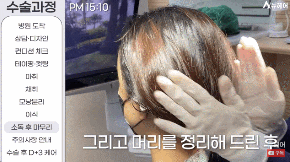 모발이식과정? A~Z 전부 공개합니다(동영상 포함) 관련 이미지 11