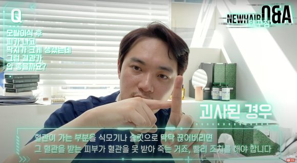 모발이식 후 피 딱지, 모발이식 결과에 미치는 영향 #모발이식딱지 #개구리알 관련 이미지 4