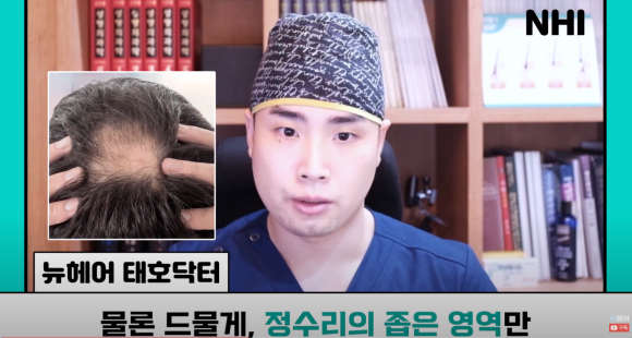 [뉴헤어] 모발이식으로도 해결 안 되는 탈모가 있다? l 탈모 주사의 효과는? 관련 이미지 11