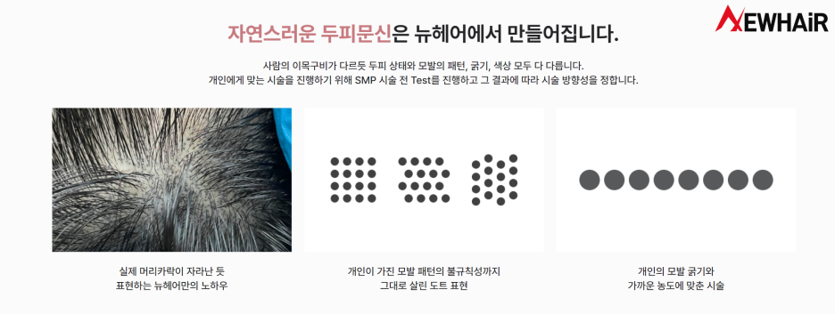 두피문신 SMP, 특징 및 부작용 관련 이미지 5