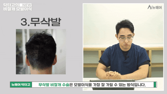 비절개모발이식 종류와 선택 가이드 관련 이미지 5