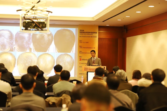 Is It True That Fatty Liver Raises the Risk of Hair Loss? image 5