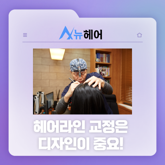 헤어라인교정수술 티 나지 않는 풍성함 관련 이미지 4