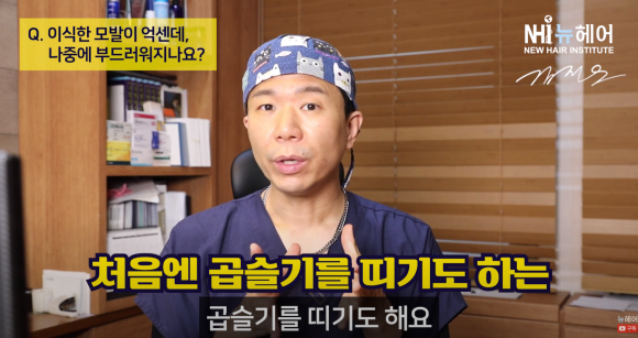 모발이식 헤어라인 교정, 이식모가 뻣뻣하다 l 곱슬머리 관련 이미지 1