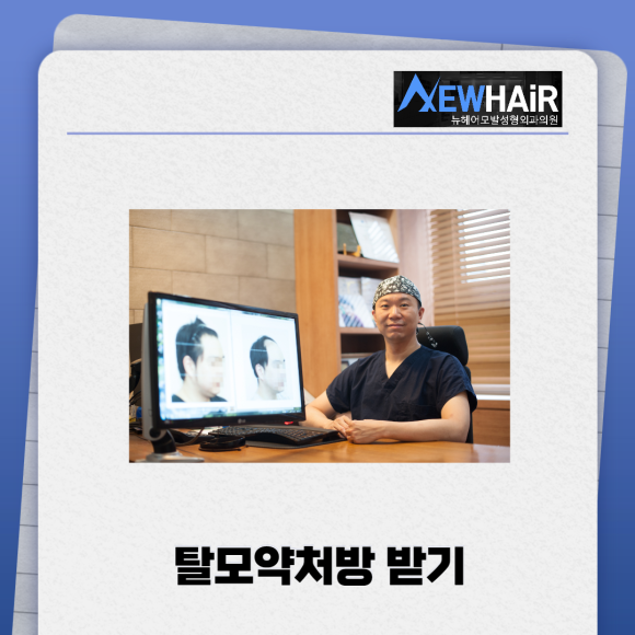 탈모약처방 찾고있다면 관련 이미지 1