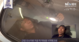 모발이식 전 알아두면 좋은 5가지 관련 이미지 4