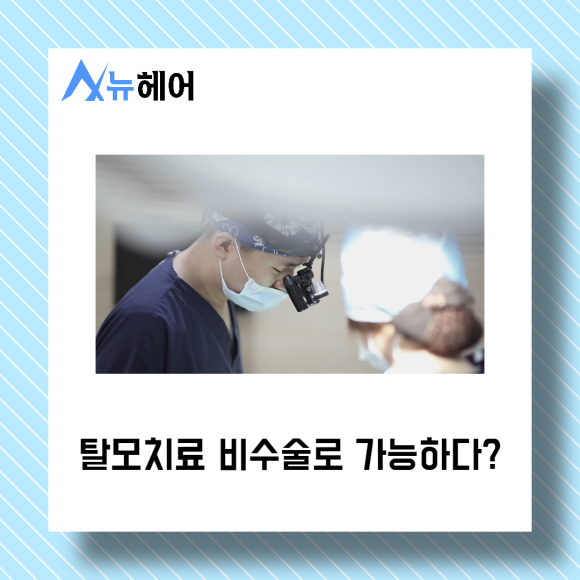 탈모치료 비수술로 가능하다? 관련 이미지 1