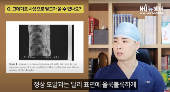 고데기 탈모? 고데기 사용 후 모발 손상... 머리숱 줄어든 느낌이라면 관련 이미지 5