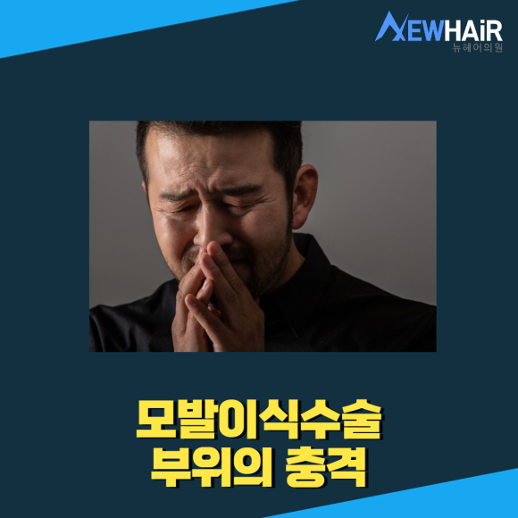 서울탈모 모발이식관리 중요해요 관련 이미지 4