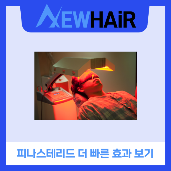 탈모약 효과 제대로 보려면? 관련 이미지 5