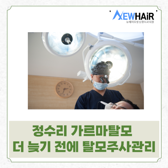 정수리 가르마탈모 더 늦기 전에 탈모주사관리 관련 이미지 1