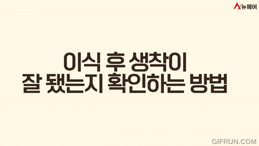 모발이식 생착스프레이에 대한 모든것! 사용기간과 비용까지! 관련 이미지 7