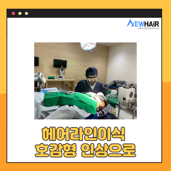 비절개 헤어라인이식으로 볼륨감있는 이마를 관련 이미지 2