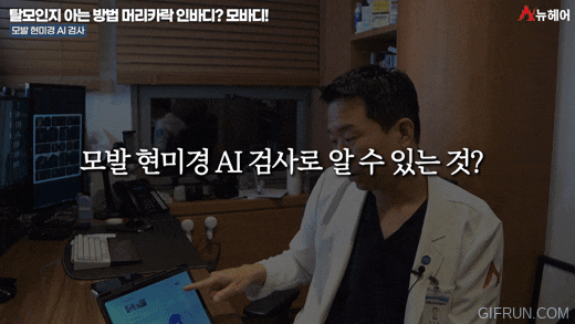 탈모 검사! 머리카락 인바디? 모바디! 관련 이미지 8