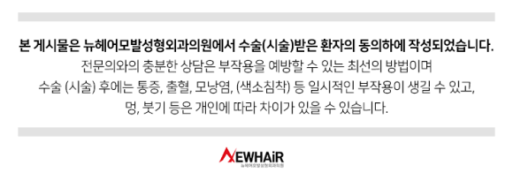 하루에 담배 00개비 피우면 탈모로 대머리 된다? 관련 이미지 8