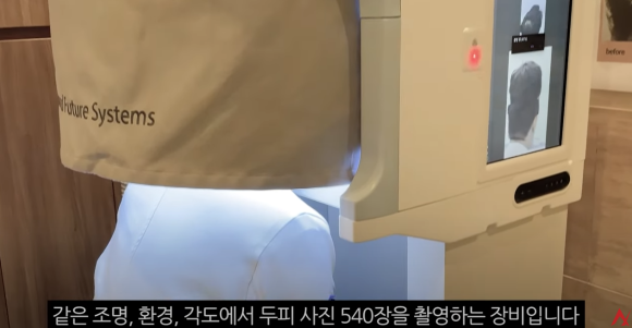 What Can Hair Loss Testing Tell Me About My Hair Loss Treatment? image 1