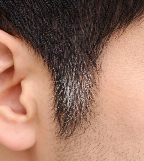 Why Do Gray Hairs Appear First Only at the Sideburns? Is There Really a Separate Reason? image 1