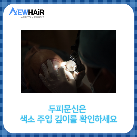 SMP 두피문신 자연스럽게 탈모커버 관련 이미지 5