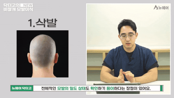 비절개모발이식 종류와 선택 가이드 관련 이미지 2