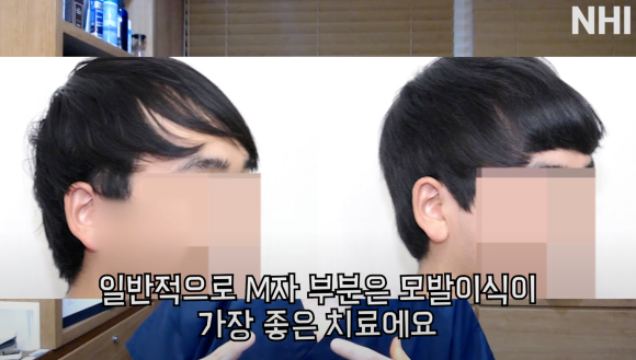 엠자탈모 / 정수리탈모 / 여성탈모 각각 탈모치료법 소개, 탈모약 효과 관련 이미지 2