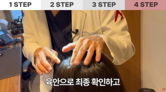 머리카락 많이 빠지면 탈모일까? 정상 기준은? 관련 이미지 7