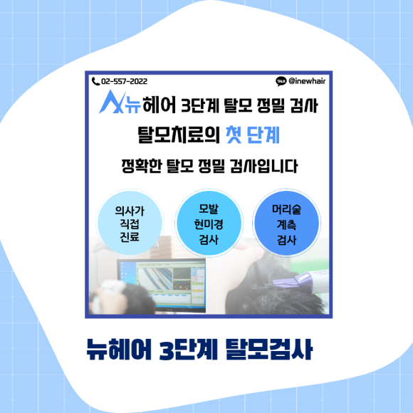엠자탈모 확실한 치료법은? 관련 이미지 5