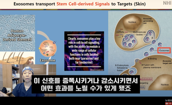 탈모치료 엑소좀, 엑소좀 뜻, 역할, 탈모 치료 효과ㅣ 정수리 탈모 ㅣ 전후사진 관련 이미지 7