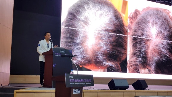 탈모주사 가격? 주기? 주의사항? 현직 의사가 총정리합니다 관련 이미지 2