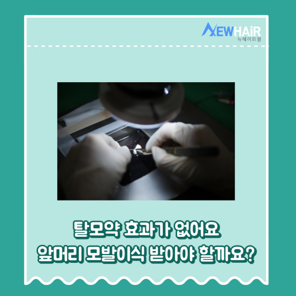 앞머리모발이식 만족하는 결과를 관련 이미지 3