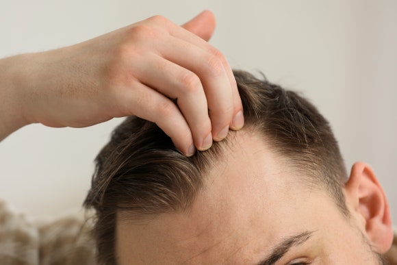 Can oral hair loss medications (finasteride, dutasteride) also cause shedding? image 3