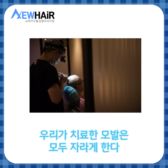 SMP 두피문신 자연스럽게 탈모커버 관련 이미지 8