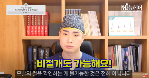 비절개 모발이식도 OK! 머리카락 방향 정확하게 맞춰서 이식하세요 관련 이미지 4