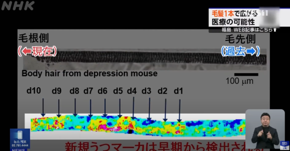 Can One Strand of Hair Reveal Your Health? A Hair Health Checkup image 5