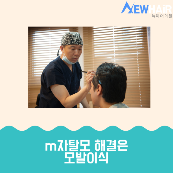 m자탈모 해결은 모발이식 관련 이미지 1