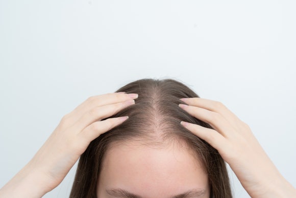 Hair Loss Combination Medication: Is Blood Pressure Okay When Taking Spironolactone? image 1