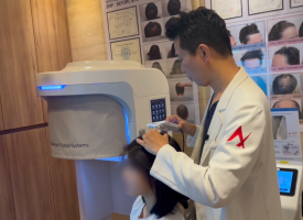 Young-Onset Hair Loss (Hair Loss in Your 20s and 30s): Why Is It Increasing? image 7