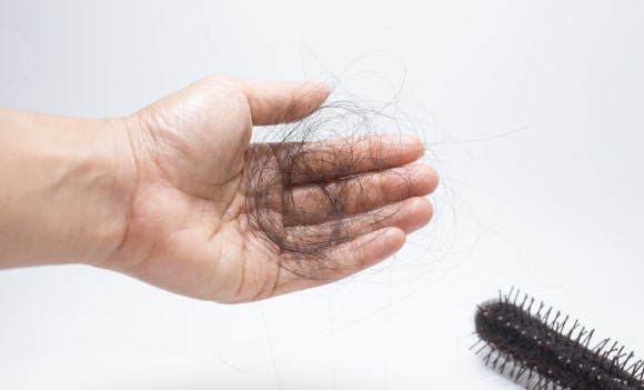 Hair Loss: Have You Also Checked Your Gut Health? image 2