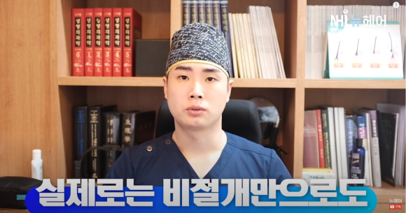 비절개로만 모발이식 1차, 2차 가능할까? l 비절개 모발이식 주의사항 관련 이미지 2