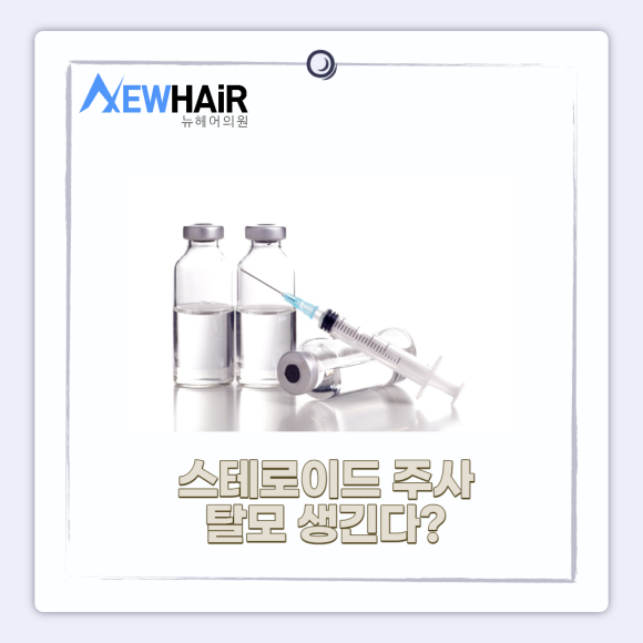 남성탈모 모발이식으로 해결 관련 이미지 4