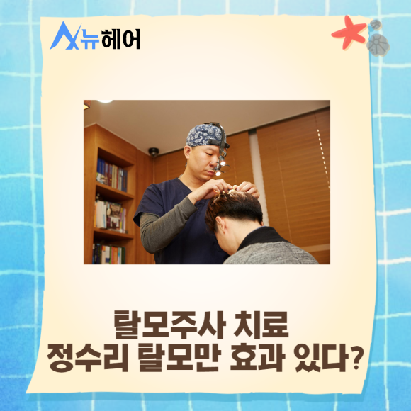 탈모주사 효과 정수리탈모 치료해요 관련 이미지 4
