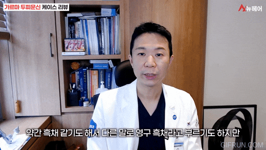 정수리탈모 가르마탈모 스트레스 때문에 두피문신했더니(두피문신 케이스리뷰) 관련 이미지 3