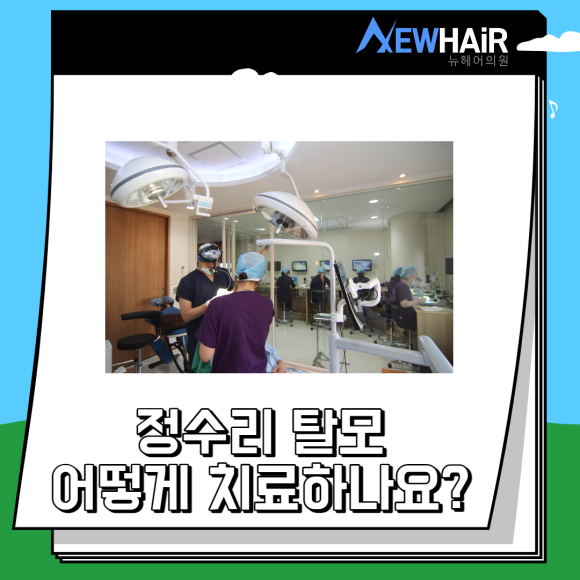 정수리탈모치료 더 늦지 않게 관련 이미지 4