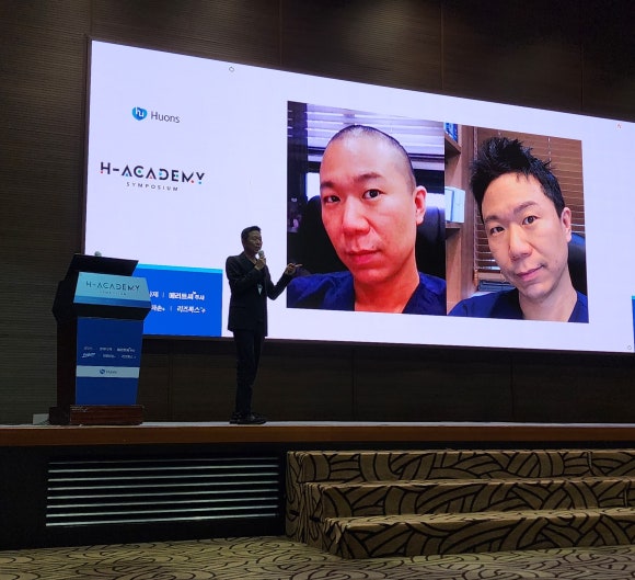 2023년 10월 11월 학술활동 정리: 보툴리눔 톡신 탈모치료 및 바르는 피나스테리드 발표 [코아트,휴온스 심포지엄] 관련 이미지 7
