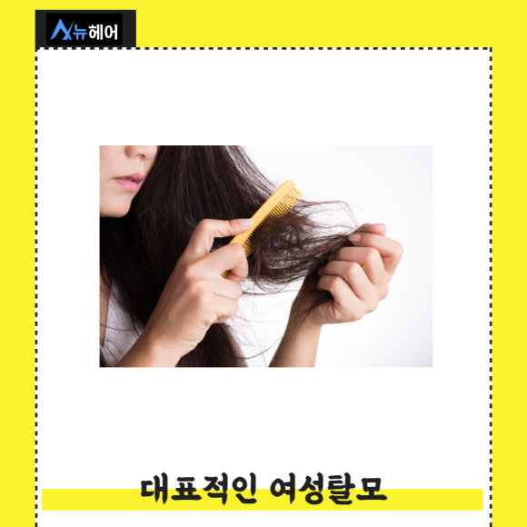 출산 여성탈모 빠른 회복방법은? 관련 이미지 2
