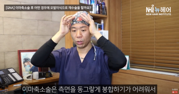 이마축소술했지만 모발이식 재수술하는 경우 ㅣ헤어라인교정 ㅣ 이마축소술 흉터 관련 이미지 5