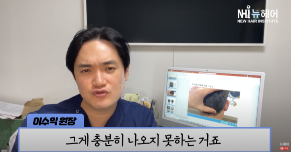 모발이식 실패? 이식모가 빠질 수 있나요? 관련 이미지 18