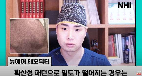 [뉴헤어] 모발이식으로도 해결 안 되는 탈모가 있다? l 탈모 주사의 효과는? 관련 이미지 14