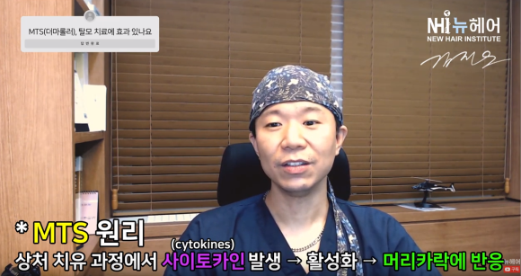 더마롤러 MTS 홈케어 탈모에 효과 있을까? ㅣ 미녹시딜 사용법 관련 이미지 3