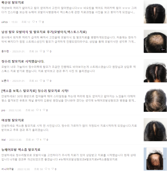 뉴헤어모발성형외과, 치료결과가 좋은 이유? - 17년차 성형외과전문의 김진오 드림 관련 이미지 2