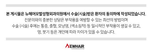 남자 탈모 vs 여자 탈모, 치료법이 다른 3가지 이유 관련 이미지 5